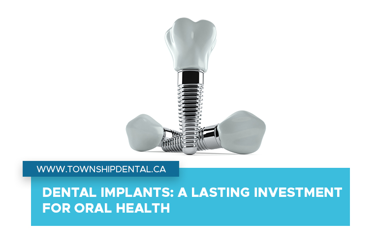 Dental Implants: A Lasting Investment for Oral Health