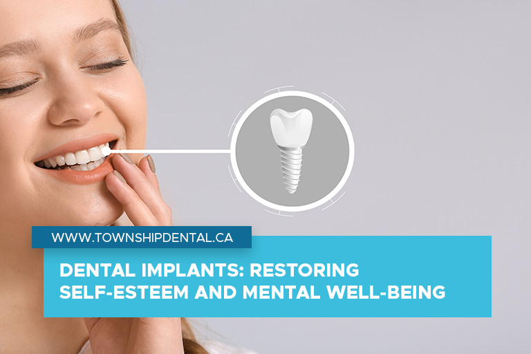 Dental Implants: Restoring Self-Esteem and Mental Well-Being