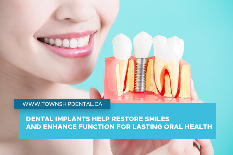 Dental implants help restore smiles and enhance function for lasting oral health
