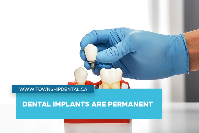 Dental implants are permanent