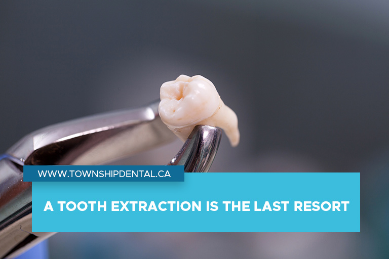 A tooth extraction is the last resort
