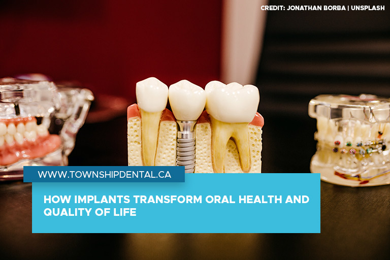 How Implants Transform Oral Health and Quality of Life