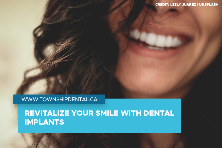 Revitalize your smile with dental implants