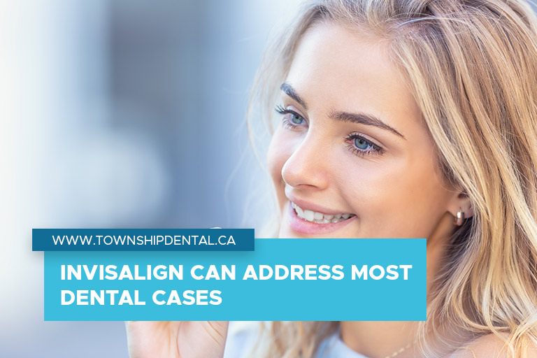 Invisalign can address most dental cases