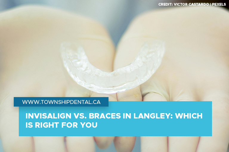 Invisalign vs. Braces in Langley Which is Right for You