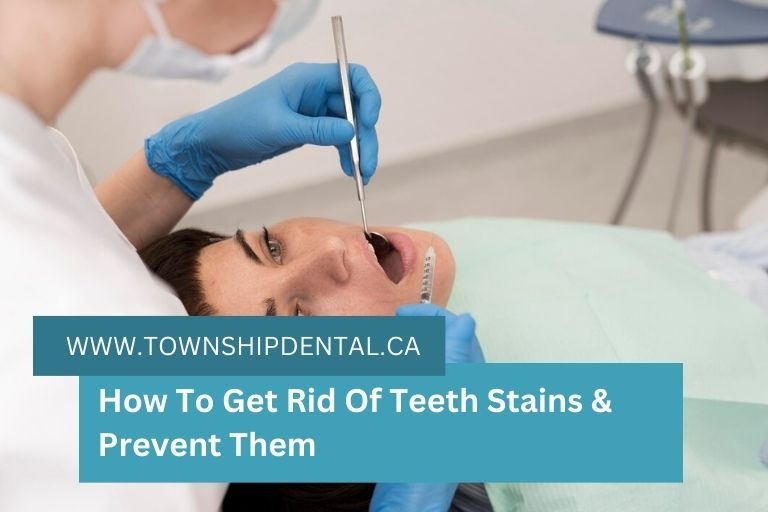 How To Get Rid Of Teeth Stains & Prevent Them