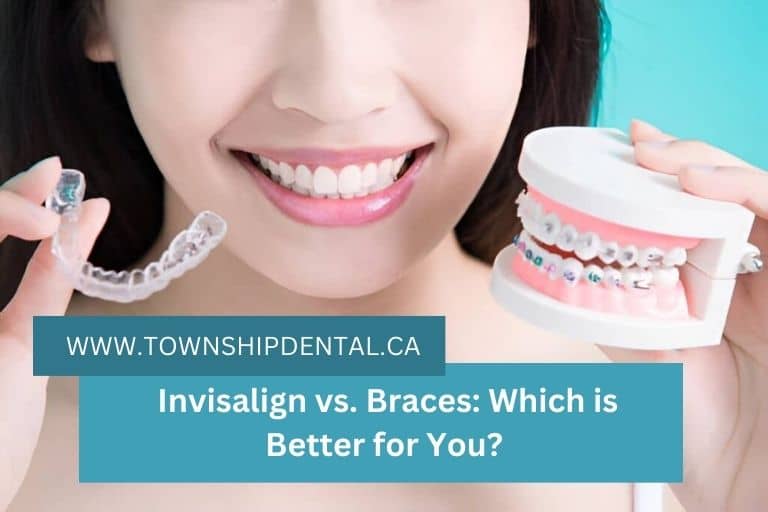 Invisalign vs. Braces: Which is Better for You?