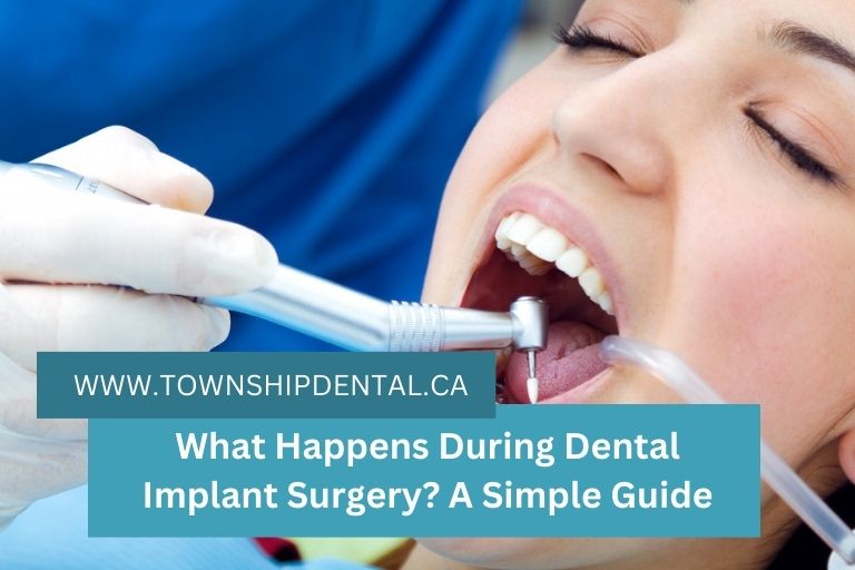 What Happens During Dental Implant Surgery? A Simple Guide