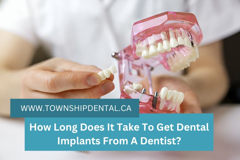 How long does it take to get dental implants from a dentist?